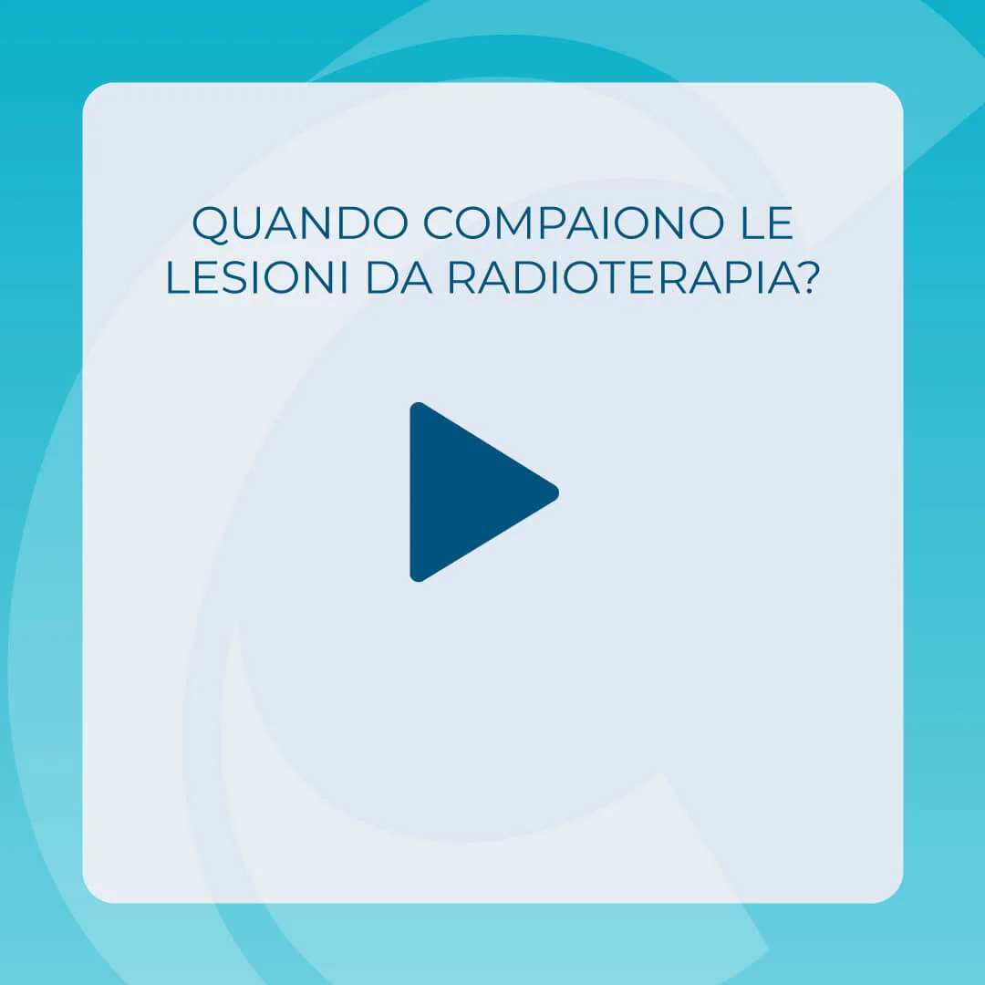 quando compaiono le lesioni da radioterapia